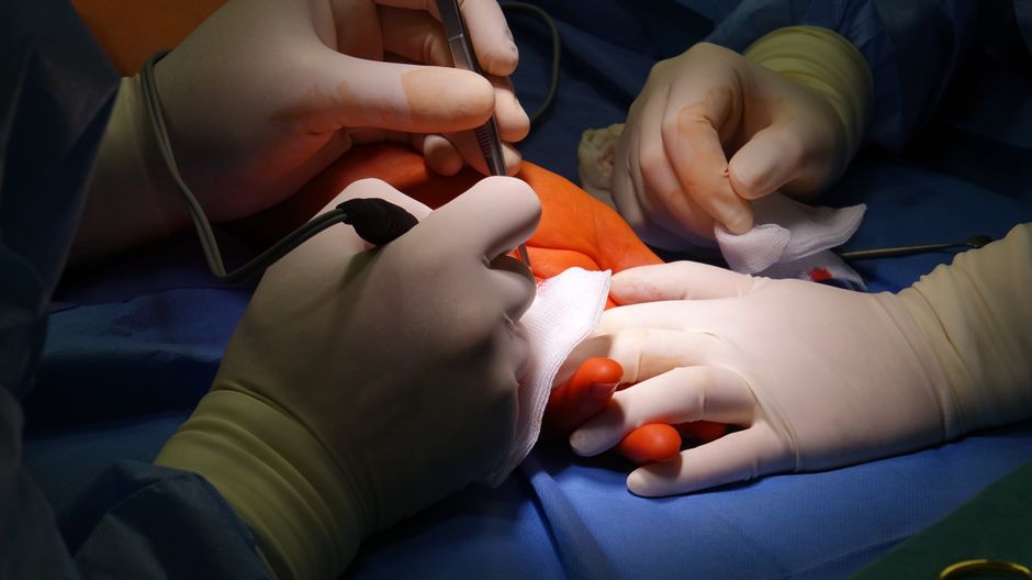 gout big toe joint pain