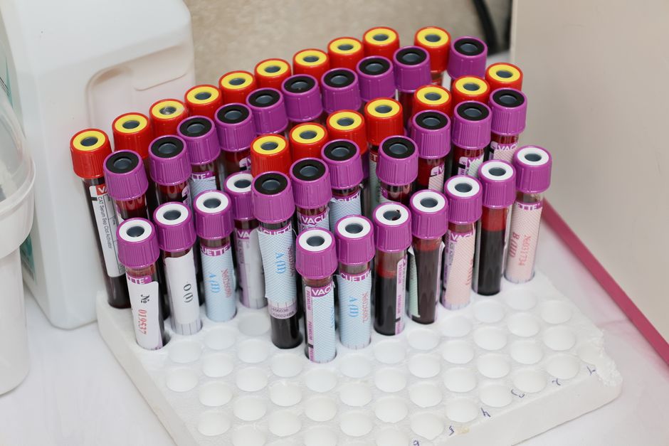 blood test laboratory hospital