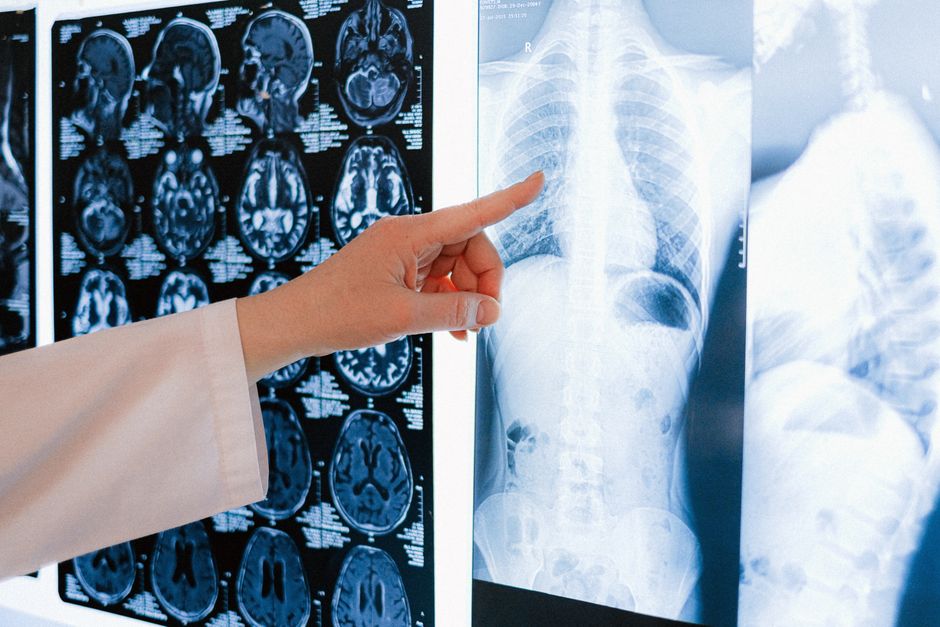 elderly woman bone density test clinic