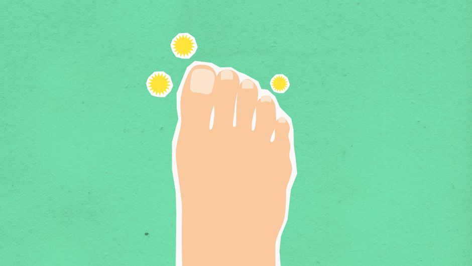 diabetic foot nerve damage illustration