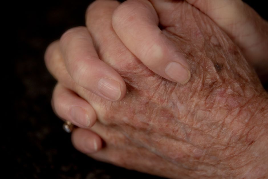 senior citizen skin care hands