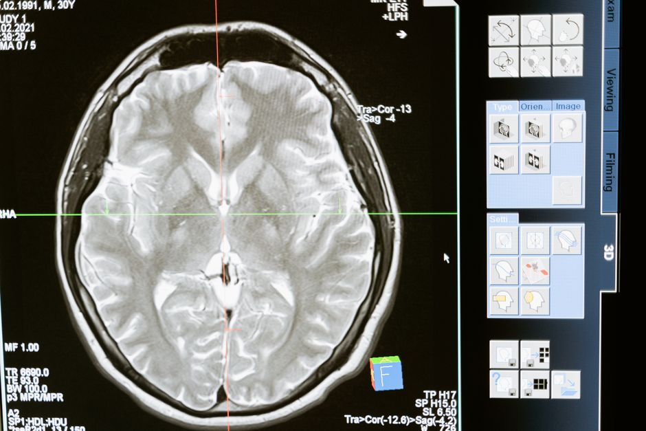 brain mri scan medical