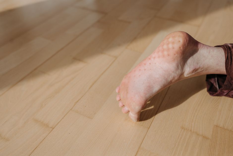 checking foot sole with mirror