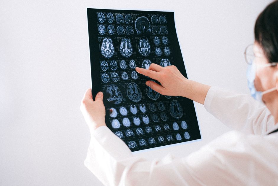 doctor consultation neurology clinic